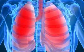 Бронхиальная астма: основные причины, методы терапии