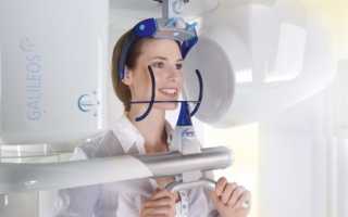 Трехмерная томография в стоматологии – показания и эффективность метода
