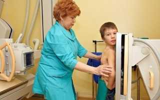 Рентгенография детям – опасности и негативные последствия