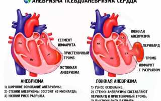 Осложнения инфаркта миокарда требующие реанимационных мероприятий