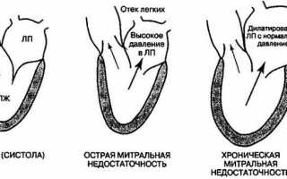 Недостаточность кровообращения