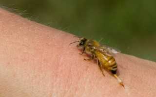 Лечение варикоза пчелами