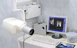 Обзор стоматологических рентгенологических установок