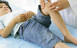 Детский ревматизм: симптомы и терапия