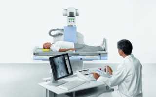 Рентгеноскопия и рентгенография: сравнение и отличие методов