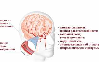 Энцефалопатия головного мозга — есть ли спасение