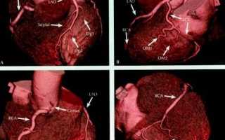 МРТ сердца с контрастированием – способ ранней диагностики кардиологических заболеваний