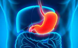 Что нужно знать о гиперплазии желудка и ее формах